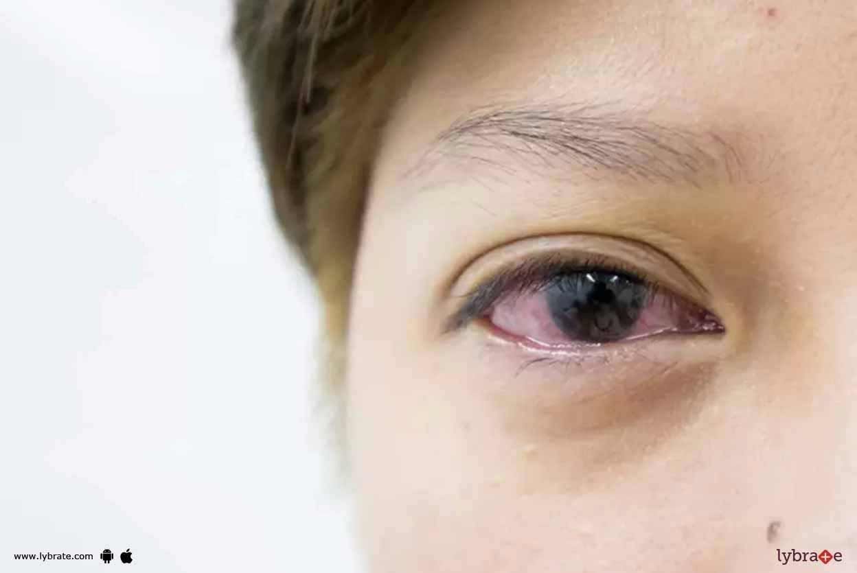 What Is Dilation Eye Exam? Why Is It Important?
